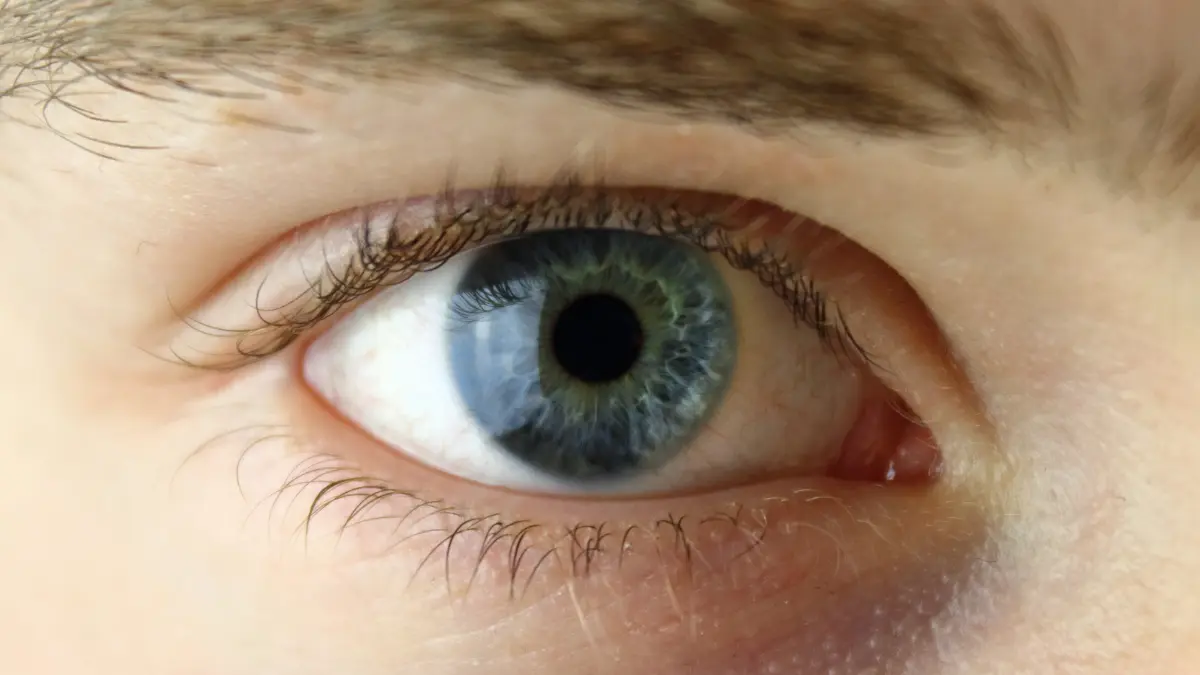Pessoas com olhos de duas cores